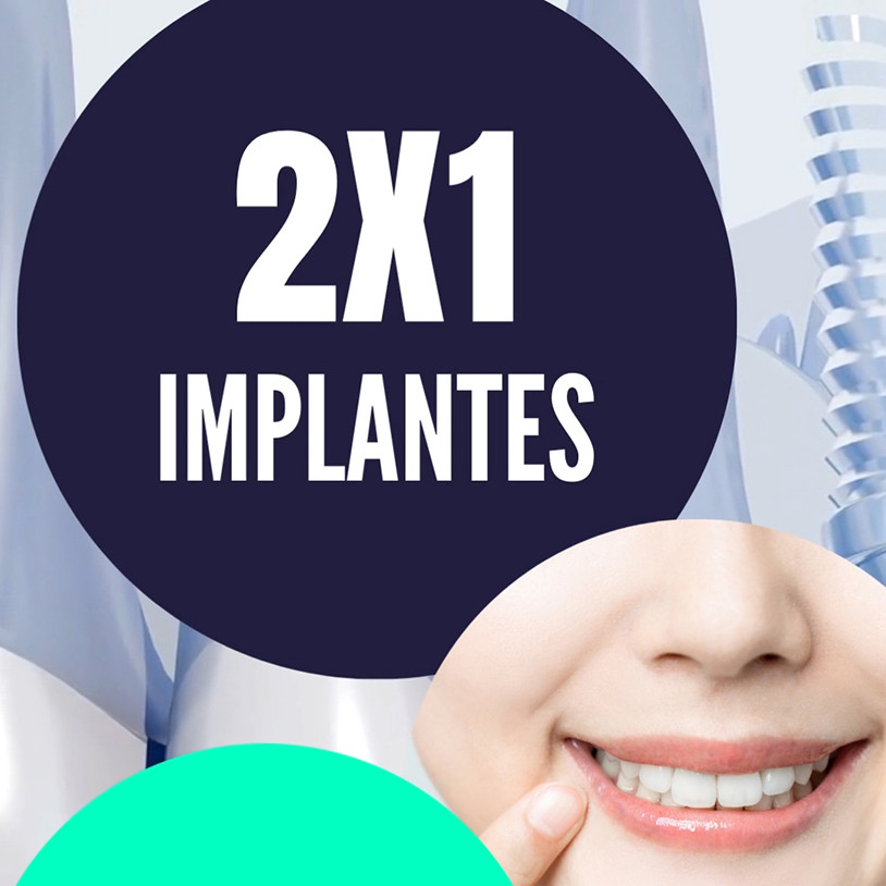 2X1 Implantes + Blanqueamiento Vertical Español