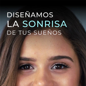 Carillas Sin desgaste...