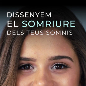 Carillas Sin desgaste...