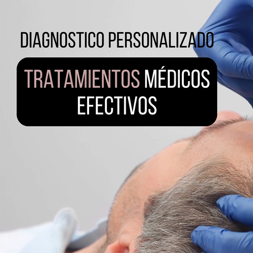 Mesoterapia Capilar Horizontal Español
