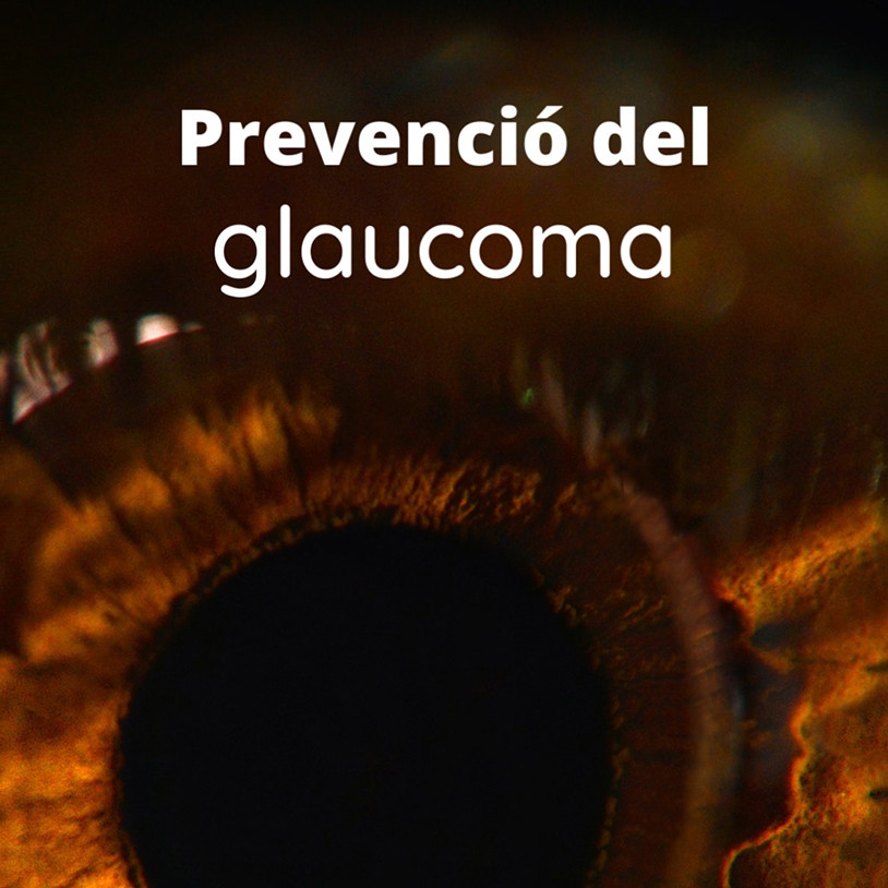 Prevención Glaucoma Vertical Catalán