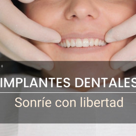 Implantes dentales...