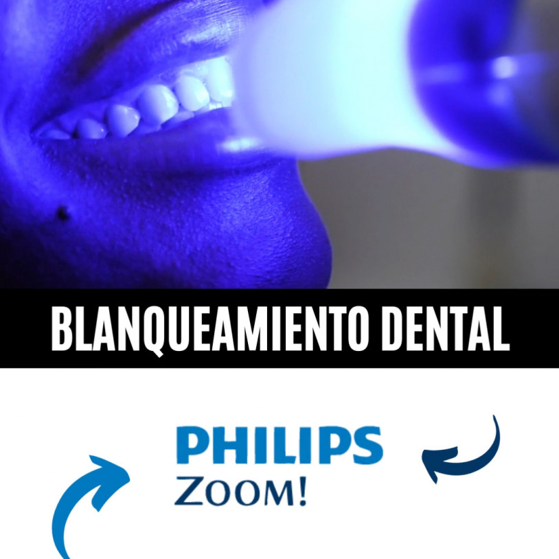 Blanqueamiento Zoom Vertical Español