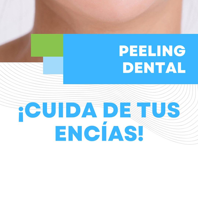 Peeling Dental Vertical Español