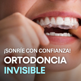 Ortodoncia invisible Spark...
