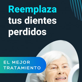 Implantes dentales Vertical...