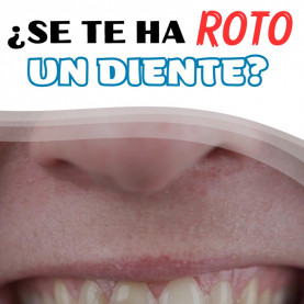 Fractura Diente Vertical...