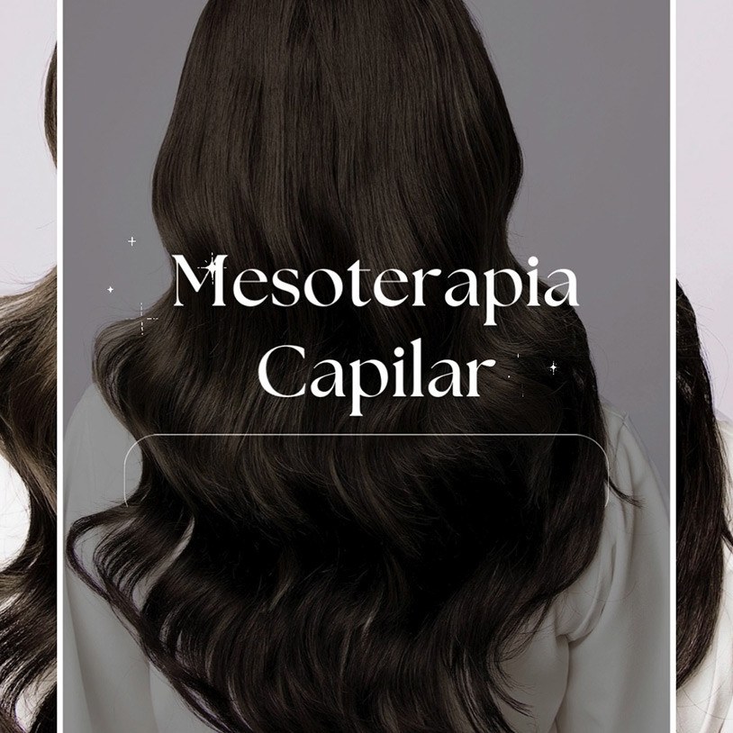 Mesoterapia Capilar Vertical Español