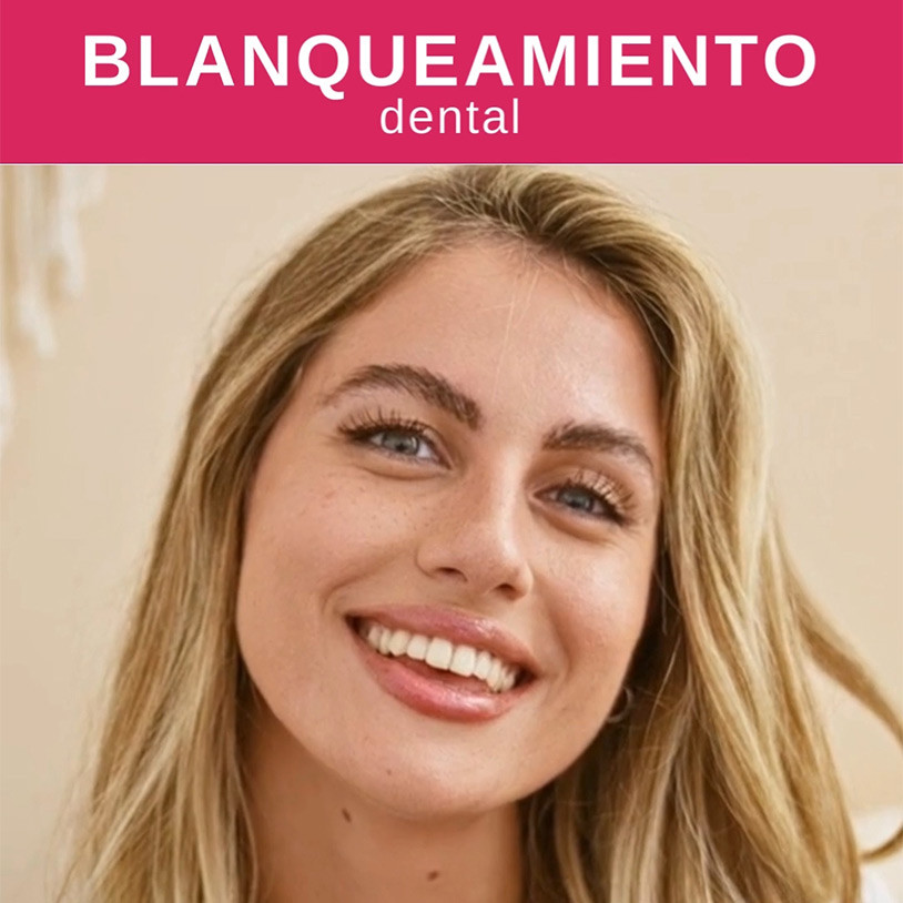 Promoción Blanqueamiento Vertical Español