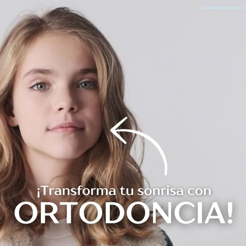 Ortodoncia Invisible o Brackets Horizontal Español