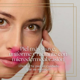 Microdermoabrasión...