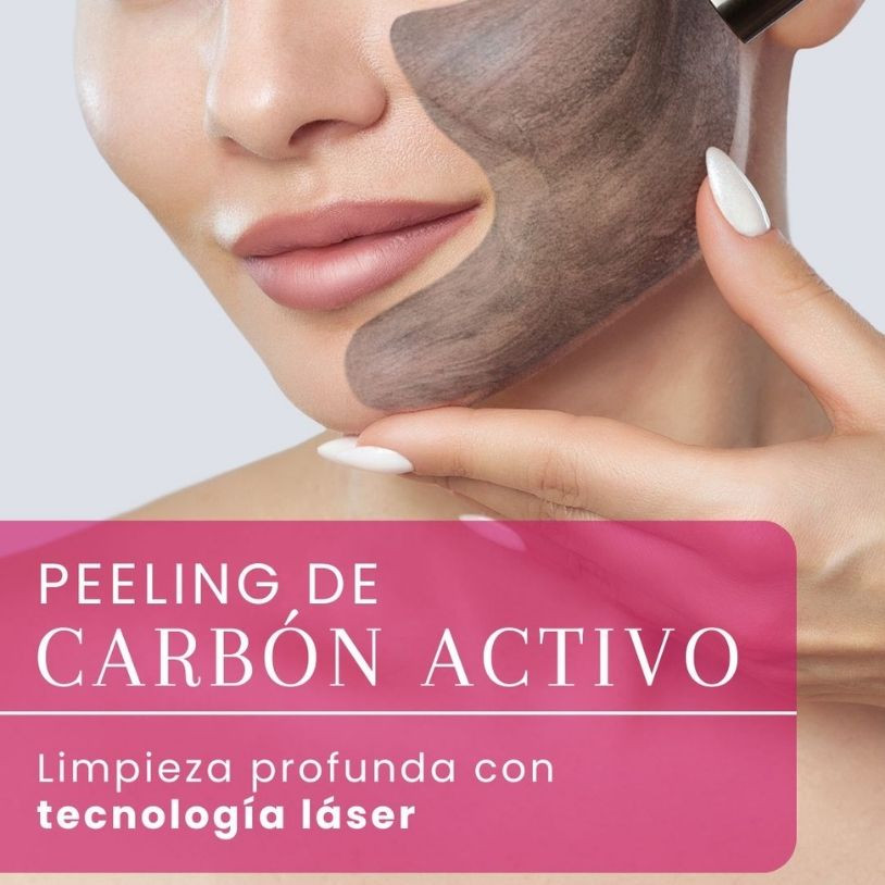 Peeling de Carbón Activo Vertical Español