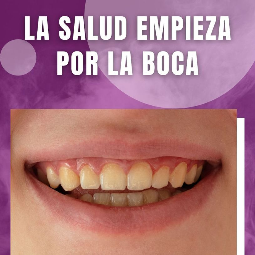 Efecto del Vapeo en la Salud Dental Vertical Español