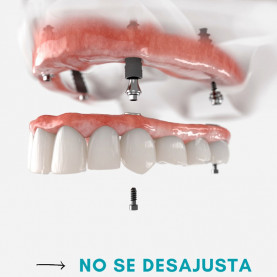 Prótesis Fija Vertical Español