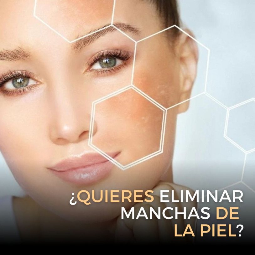 Manchas Piel Vertical Español