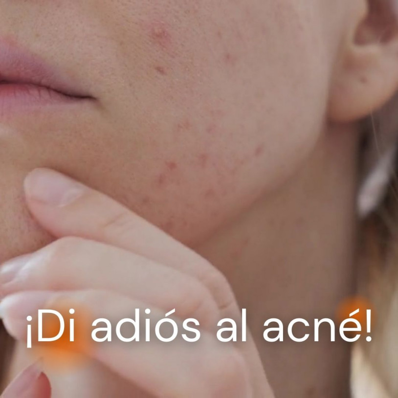 Acné Horizontal Español