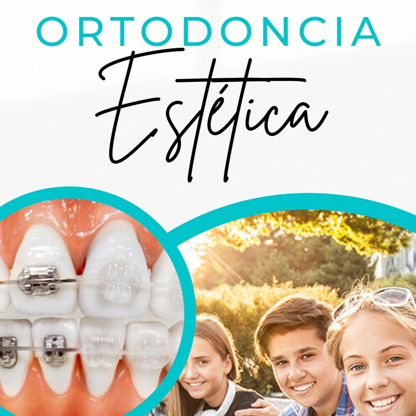 Ortodoncia Vertical Español