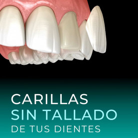 Carillas Natural Vertical...