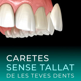 Carillas Natural Vertical...