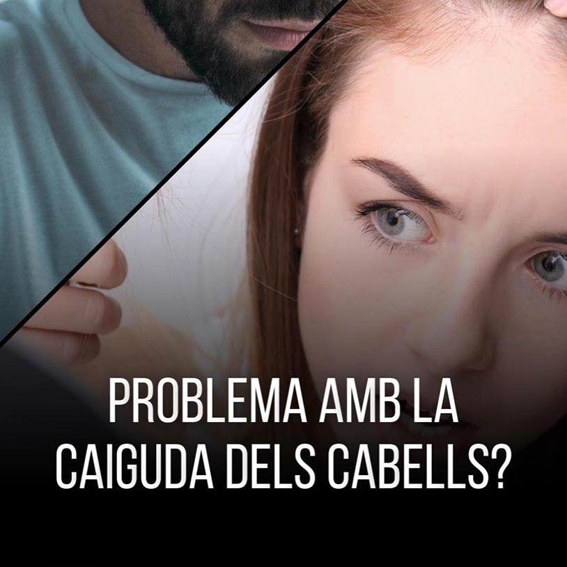 Mesoterapia Capilar Vertical Catalán