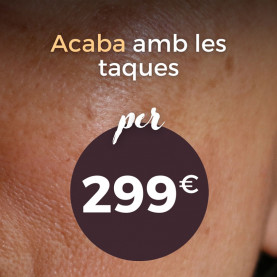 Manchas Piel Vertical Catalán