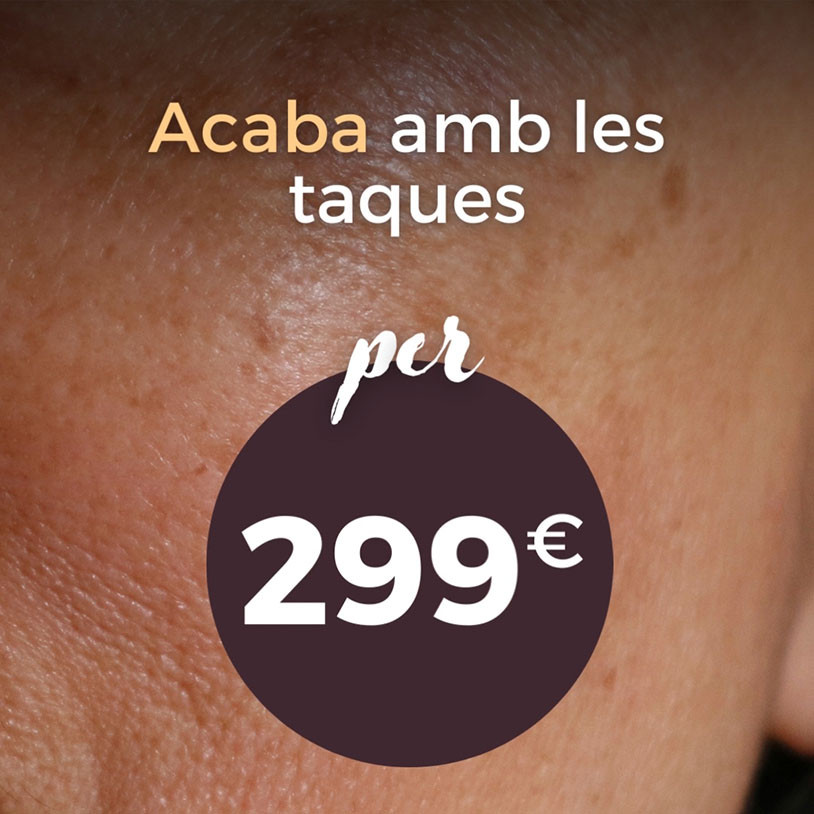 Manchas Piel Vertical Catalán