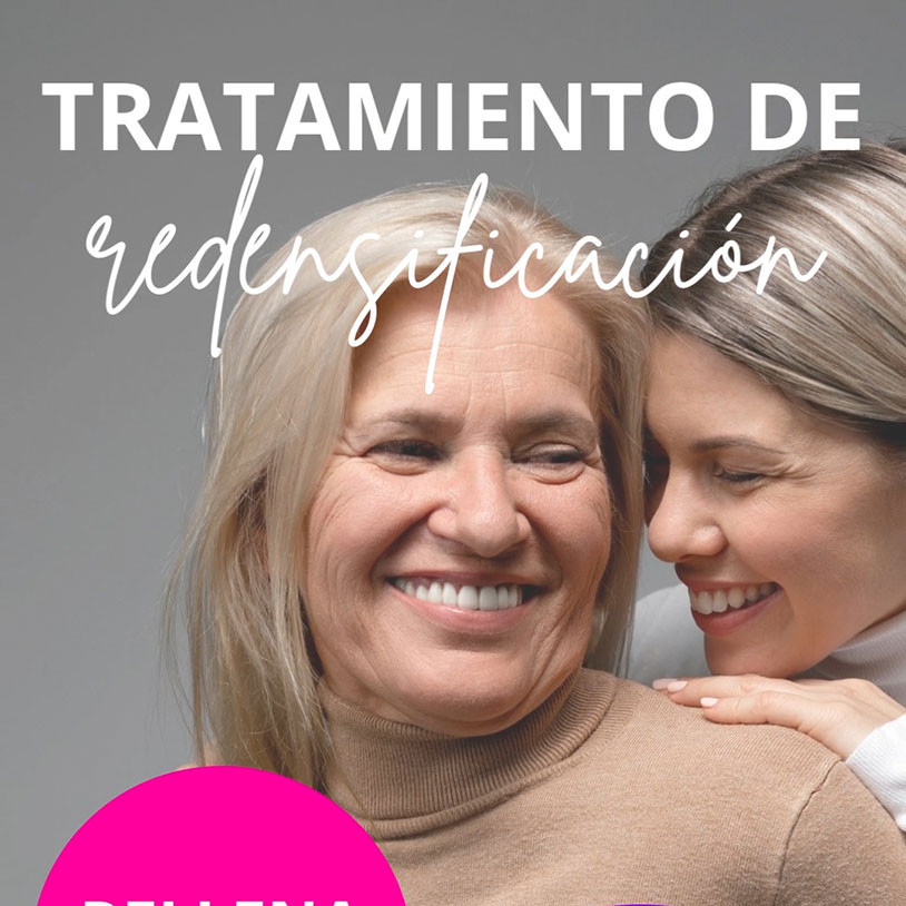 Redensificación Vertical Español